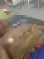 KORBAN penikaman di Desa Baruakol, Kepulauan Sula